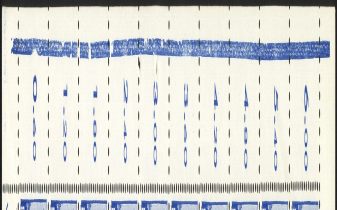 Image:ddr0420xXI.1js.small_smlflinks.jpg